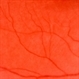 Diffuse Unilateral Subacute Neuroretinitis